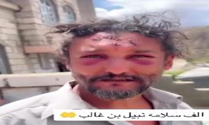 بالفأس...امرأة تعتدي على زوجها عقب مصارحتها بنيته الزواج من امرأة اخرى "صورة"
